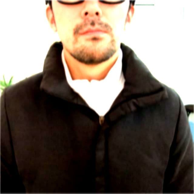 後頭部から鼻にかけての痛み改善例:37歳男性