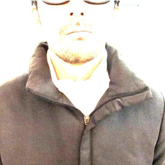 後頭部から鼻にかけての痛み改善例:37歳男性